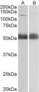 COPA antibody (0.5 ug/ml) staining of Human Prostate lysate (35 ug protein in RIPA buffer) with (B) and without (A) blocking with the immunizing peptide. Primary incubation was 1 hour. Detected by chemiluminescence.