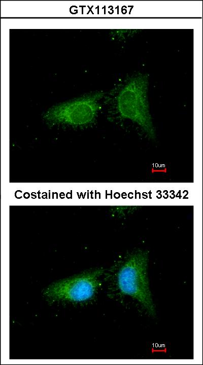 Immunofluorescence of methanol-fixed HeLa, using COPB antibody at 1:100 dilution.