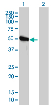 Western blot of GART expression in transfected 293T cell line by GART monoclonal antibody clone 4D6-1D5.