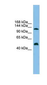 GART antibody LS-C116310 Western blot of 721_B cell lysate.