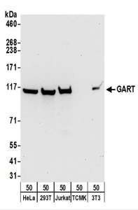 Detection of Human and Mouse GART by Western Blot. Samples: Whole cell lysate (50 ug) from HeLa, 293T, Jurkat, mouse TCMK-1, and mouse NIH3T3 cells. Antibodies: Affinity purified rabbit anti-GART antibody used for WB at 0.1 ug/ml. Detection: Chemiluminescence with an exposure time of 30 seconds.