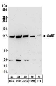 Detection of Human and Mouse GART by Western Blot. Samples: Whole cell lysate (50 ug) from HeLa, 293T, Jurkat, mouse TCMK-1, and mouse NIH3T3 cells. Antibodies: Affinity purified rabbit anti-GART antibody used for WB at 0.1 ug/ml. Detection: Chemiluminescence with an exposure time of 3 minutes.