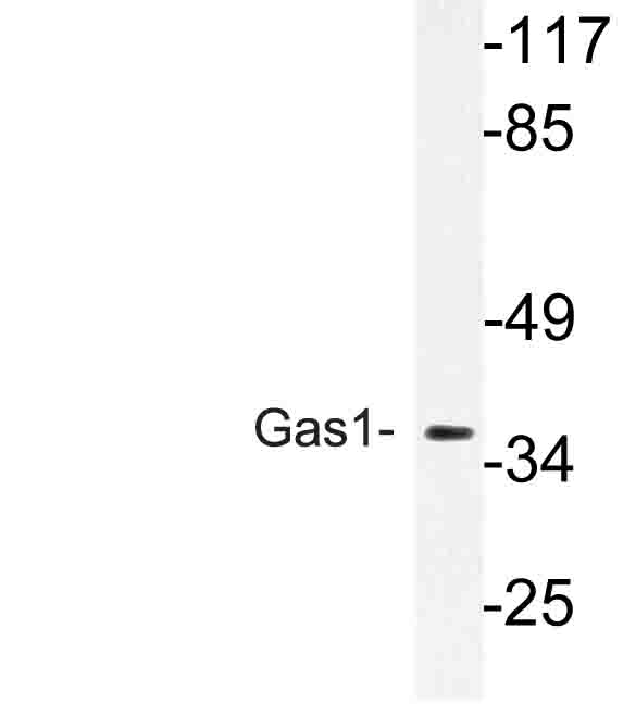 Western blot of Gas1 (R274) pAb in extracts from MCF-7 cells.