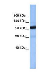Fetal liver cell lysate. Antibody concentration: 1.0 ug/ml. Gel concentration: 6%-18%.