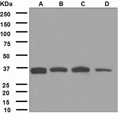 Western blot analysis on (A) HepG2, (B) fetal liver, (C) fetal kidney, and (D) Jurkat lysates using anti-Gas-2 antibody.