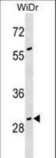 GAS2 Antibody western blot of WiDr cell line lysates (35 ug/lane). The GAS2 antibody detected the GAS2 protein (arrow).