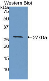 Western blot of recombinant GAS2.