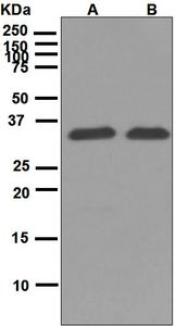 Western blot analysis on (A) HepG2 and (B) Jurkat treated with staurosporine cell lysates using anti-GAS2 antibody.