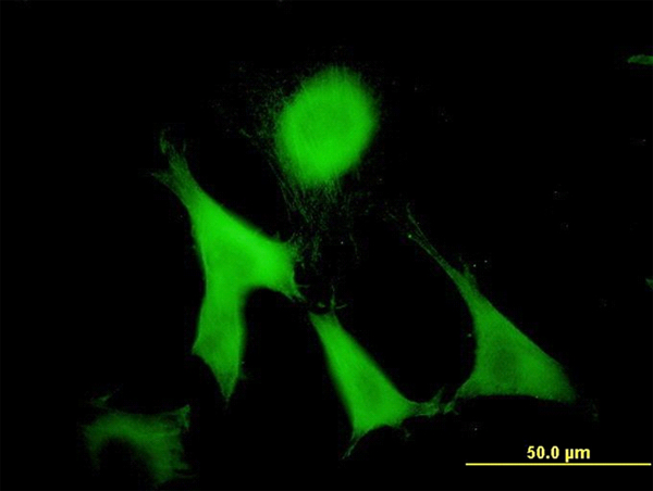 Immunofluorescence of monoclonal antibody to GAS2 on NIH/3T3 cell. [antibody concentration 10 ug/ml]