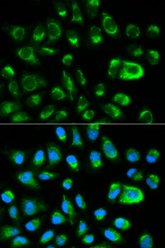 Immunofluorescence analysis of HeLa cell using GAS2 antibody. Blue: DAPI for nuclear staining.