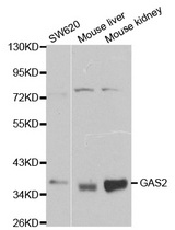 Western blot analysis of extracts of various cell lines, using GAS2 antibody.