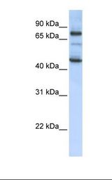 MCF7 cell lysate. Antibody concentration: 1.0 ug/ml. Gel concentration: 12%.