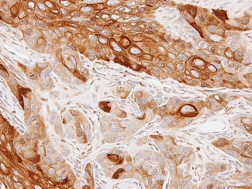 IHC of paraffin-embedded SCC4 xenograft using GAS2L1 antibody at 1:100 dilution.