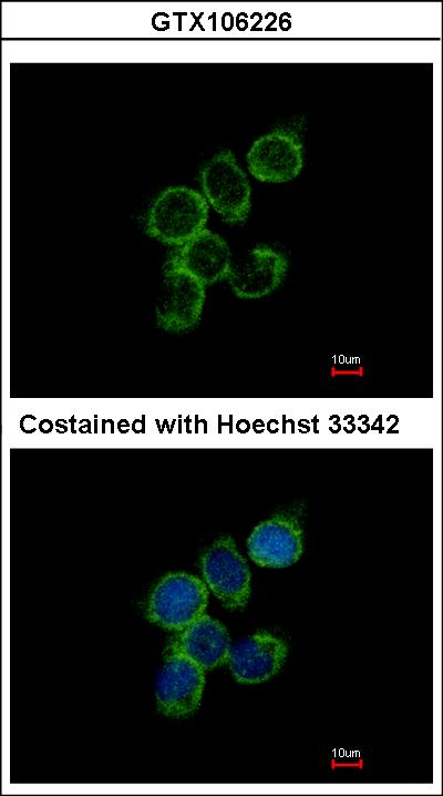 Immunofluorescence of methanol-fixed A431 using GAS2L1 antibody at 1:500 dilution.