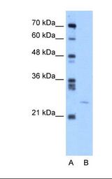 Lane A: Marker. Lane B: Jurkat cell lysate. Antibody concentration: 5.0 ug/ml. Gel concentration: 12%.