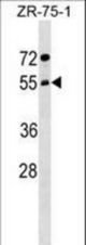 ARCN1 Antibody western blot of ZR-75-1 cell line lysates (35 ug/lane). The ARCN1 antibody detected the ARCN1 protein (arrow).