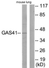 Western blot of extracts from mouse lung cells, using GAS41 Antibody. The lane on the right is treated with the synthesized peptide.