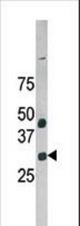 Western blot of anti-NuBI-1 antibody in HepG2 cell line lysate. NuBI-1(arrow) was detected using the purified antibody.