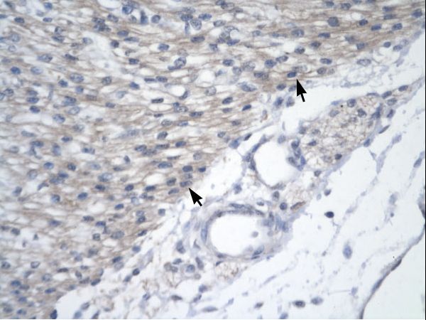 YEATS4 antibody LS-C29729 was used in IHC to stain formalin-fixed, paraffin-embedded human heart.
