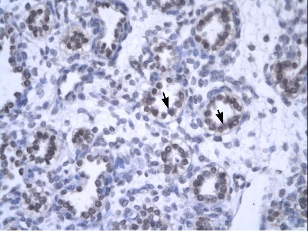 YEATS4 antibody LS-C29729 was used in IHC to stain formalin-fixed, paraffin-embedded human lung.