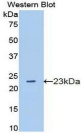 Western blot of recombinant GAS6.