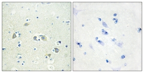 IHC of paraffin-embedded human brain tissue, using GAS6 Antibody. The picture on the right is treated with the synthesized peptide.