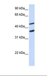MCF7 cell lysate. Antibody concentration: 1.0 ug/ml. Gel concentration: 12%.