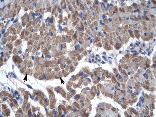 GAS7 antibody LS-C31663 was used in IHC to stain formalin-fixed, paraffin-embedded human muscle.