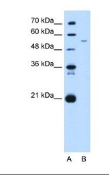 Lane A: Marker. Lane B: HepG2 cell lysate. Antibody concentration: 5.0 ug/ml. Gel concentration: 12%.