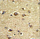 Formalin-fixed and paraffin-embedded human brain tissue reacted with GAS7 Antibody , which was peroxidase-conjugated to the secondary antibody, followed by DAB staining. This data demonstrates the use of this antibody for immunohistochemistry; clinical relevance has not been evaluated.