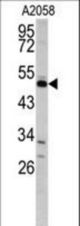 Western blot of GAS7 antibody in A2058 cell line lysates (35 ug/lane). GAS7 (arrow) was detected using the purified antibody.