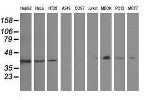 Western blot of extracts (35 ug) from 9 different cell lines by using anti-GAS7 monoclonal antibody.