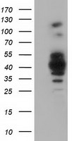 HEK293T cells were transfected with the pCMV6-ENTRY control (Left lane) or pCMV6-ENTRY GAS7 (Right lane) cDNA for 48 hrs and lysed. Equivalent amounts of cell lysates (5 ug per lane) were separated by SDS-PAGE and immunoblotted with anti-GAS7.