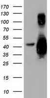 HEK293T cells were transfected with the pCMV6-ENTRY control (Left lane) or pCMV6-ENTRY GAS7 (Right lane) cDNA for 48 hrs and lysed. Equivalent amounts of cell lysates (5 ug per lane) were separated by SDS-PAGE and immunoblotted with anti-GAS7.