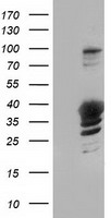 HEK293T cells were transfected with the pCMV6-ENTRY control (Left lane) or pCMV6-ENTRY GAS7 (Right lane) cDNA for 48 hrs and lysed. Equivalent amounts of cell lysates (5 ug per lane) were separated by SDS-PAGE and immunoblotted with anti-GAS7.