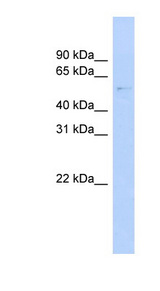 GAS8 antibody LS-C116347 Western blot of MCF7 cell lysate.