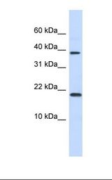 Fetal heart lysate. Antibody concentration: 1.0 ug/ml. Gel concentration: 10-20%.