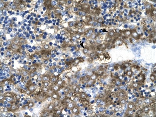 GATA2 antibody LS-C31147 was used in IHC to stain formalin-fixed, paraffin-embedded human liver.