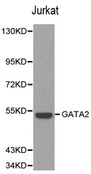 Western blot of GATA2 pAb in extracts from Jurkat cells.