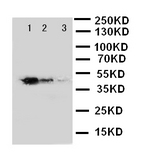 WB of GATA2 antibody. Recombinant Protein Detection Source:. E.coli derived -recombinant Human GATA2, 38.3KD. (162aa tag+ M1-G200). Lane 1: Recombinant Human GATA2 Protein 10ng. Lane 2: Recombinant Human GATA2 Protein 5ng. Lane 3: Recombinant Human GATA2 Protein 2.5ng.