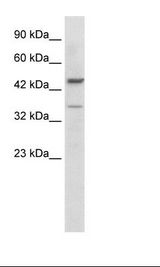 Jurkat Cell Lysate