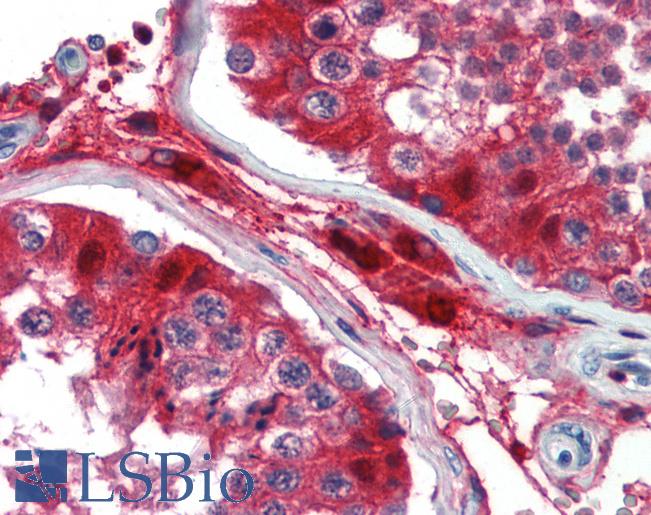 Anti-GATA3 antibody IHC of human testis. Immunohistochemistry of formalin-fixed, paraffin-embedded tissue after heat-induced antigen retrieval. Antibody LS-B3482 concentration 5 ug/ml.