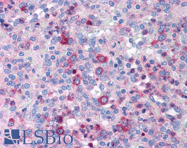 Anti-GATA3 antibody IHC of human spleen. Immunohistochemistry of formalin-fixed, paraffin-embedded tissue after heat-induced antigen retrieval. Antibody LS-B958 concentration 5 ug/ml.
