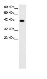 Jurkat Cell Lysate