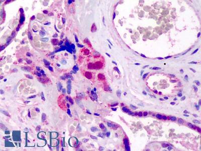 Anti-GATA3 antibody IHC of human placenta. Immunohistochemistry of formalin-fixed, paraffin-embedded tissue after heat-induced antigen retrieval. Antibody LS-B4879 concentration 3.75 ug/ml.