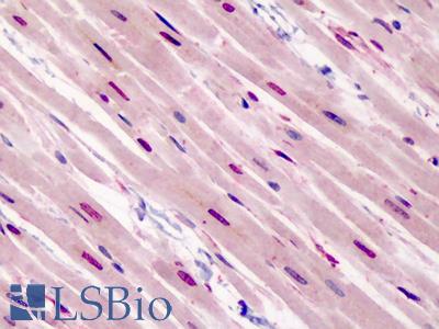 Anti-GATA3 antibody IHC of human heart. Immunohistochemistry of formalin-fixed, paraffin-embedded tissue after heat-induced antigen retrieval. Antibody LS-B4879 concentration 3.75 ug/ml.