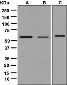 Western blot analysis on (A) HepG2, (B) Caco-2, and (C) HeLa cell lysates using anti-GATA4 antibody.