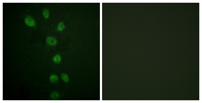 Immunofluorescence of HepG2 cells, using GATA4 (Phospho-Ser105) Antibody. The sample on the right was incubated with synthetic peptide.