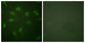Immunofluorescence of HeLa cells, using GATA4 (Ab-105) Antibody. The picture on the right is treated with the synthesized peptide.