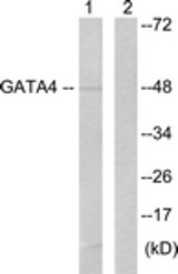 Western blot of extracts from HeLa cells, using GATA4 (Ab-105) Antibody. The lane on the right is treated with the synthesized peptide.